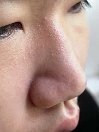 세뚜아(Cettua) 세뚜아 스티키 포어 패치 Cettua Sticky Pore Patch — 4.5점을 준 리뷰어가 2023년 6월 올린 사용 사진