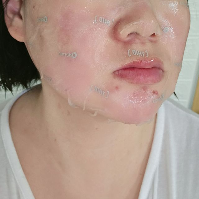 자사몰 구매평 [THID] 마이크로커런트 슬리밍 리뷰 사진