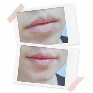 [라끄본] 립 세럼 - 트릿츠 립세럼 — 4.5점을 준 리뷰어가 2021년 2월 올린 사용 사진