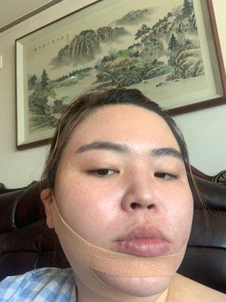 아이디플라코스메틱 아이디 페이스핏 마이너스 밴드 v2 — 1.5점을 준 리뷰어가 2021년 11월 올린 사용 사진