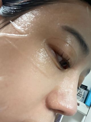 셀몽드 링클 이레이저 스팟 세럼 +핵산 미라클 앰플 마스크 — 5점을 준 리뷰어가 2022년 2월 올린 사용 사진