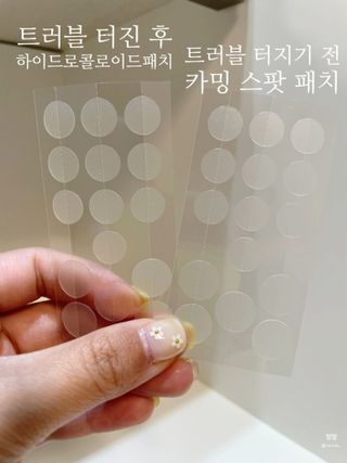 세뚜아(Cettua) 세뚜아 스팟 클리어 듀얼 패치 Cettua Spot Clear Dual Patch — 5점을 준 리뷰어가 2023년 6월 올린 사용 사진