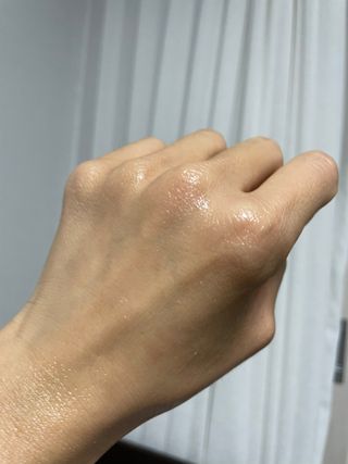 바이오오일 [바이오-오일] 드라이 스킨 젤 100ml — 5점을 준 리뷰어가 2021년 12월 올린 사용 사진