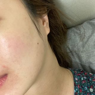 닥터마시멜로 닥터마스멜로 마블러스 아쿠아 클리닉 마스크 — 5점을 준 리뷰어가 2021년 3월 올린 사용 사진