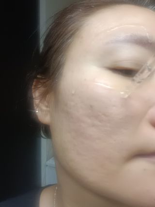 [스킨1004] 마다가스카르 센텔라 앰플 100ml — 5점을 준 리뷰어가 2024년 5월 올린 사용 사진
