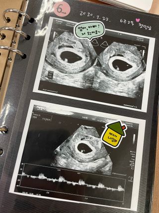 오리부인님이 올린 리뷰 사진 2