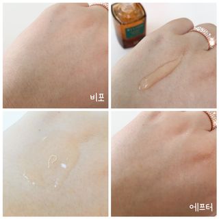 바이리뮤 에이지 홀딩 펩타톡스 앰플 — 3.5점을 준 리뷰어가 2020년 12월 올린 사용 사진
