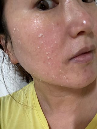 ★셀인키 8종 홈케어라인★  [신부관리템]부산해운대,강남,제주도 등 전국 병원,피부샵 입점중 — 5점을 준 리뷰어가 2024년 3월 올린 사용 사진