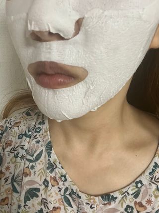 아이디플라코스메틱 페이스핏 플라스터 마스크 _ 리뉴얼 — 5점을 준 리뷰어가 2022년 5월 올린 사용 사진