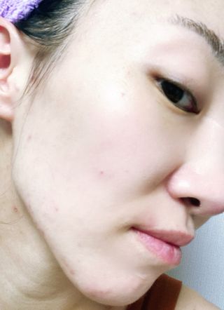 프리 (블로그체험단) [밀리밀리] 메디 앰플 비타 15ml — 5점을 준 리뷰어가 2025년 7월 올린 사용 사진