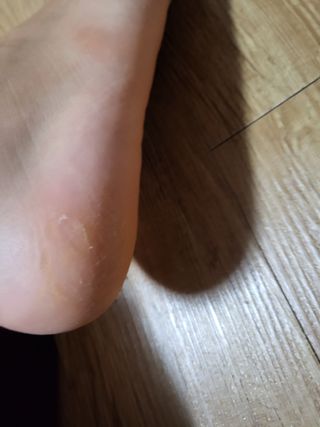 미라클풋 유리발각질제거기 물없이 쓱싹쓱싹 몇번만에 발각질 완벽제거 — 5점을 준 리뷰어가 2021년 9월 올린 사용 사진