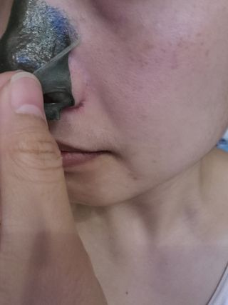 [후르디아] 저자극 필오프팩, 청포도 노즈팩 — 5점을 준 리뷰어가 2023년 8월 올린 사용 사진