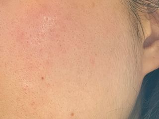 [스킨1004] 마다가스카르 센텔라 앰플 100ml — 5점을 준 리뷰어가 2024년 5월 올린 사용 사진