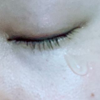 작심연구소 바르는 피부과 레이저 메디스팟크림 플러스 — 4.5점을 준 리뷰어가 2022년 7월 올린 사용 사진