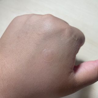 올리브영 엘라밴드 하이드로 도트 스팟패치 12mm, 티트리 — 5점을 준 리뷰어가 2022년 9월 올린 사용 사진