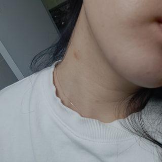 히루스카 포스트아크네 클리어 — 4.5점을 준 리뷰어가 2020년 12월 올린 사용 사진