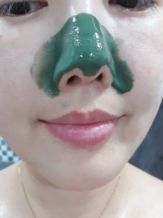 [후르디아] 저자극 필오프팩, 청포도 노즈팩 — 4점을 준 리뷰어가 2023년 8월 올린 사용 사진