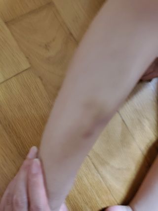젠바이오 코스메틱스 젠바이오수딩크림]   가려운 피부 & 아토피 원픽 크림 — 5점을 준 리뷰어가 2022년 9월 올린 사용 사진