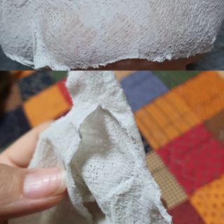 아이디플라코스메틱 페이스핏 플라스터 마스크 _ 리뉴얼 — 5점을 준 리뷰어가 2021년 7월 올린 사용 사진
