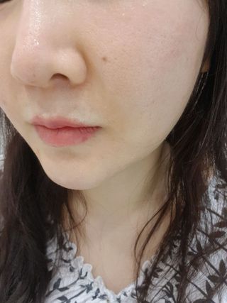 닥터초이스 [쿠팡 구매평] 황해쑥 시카엑소좀 카밍 앰플 PDRN  나이아신 IGF FGF AHA BHA 트러블케어 특허, 1개, 30g — 5점을 준 리뷰어가 2025년 6월 올린 사용 사진