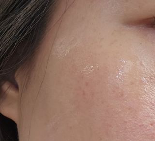 [베르비아떼] 소나무의 강인한 생명력으로 시간을 되돌리는 힘 레드파인 3종 세트 (토너, 에센스, 크림) — 5점을 준 리뷰어가 2023년 6월 올린 사용 사진