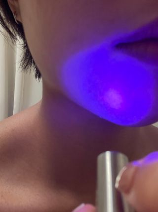 메데스 비츠케어 모공케어 피부관리키트 — 3점을 준 리뷰어가 2021년 7월 올린 사용 사진