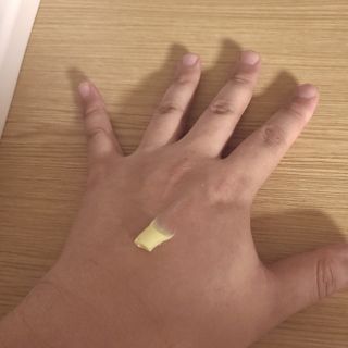 건선/아토/습진/민감성 피부 천연보습진정크림 소리온 크림 & 센시티브 크림 50g — 5점을 준 리뷰어가 2022년 1월 올린 사용 사진