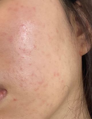 닥터펩티 펩텔라 시카웃 앰플 — 5점을 준 리뷰어가 2021년 1월 올린 사용 사진