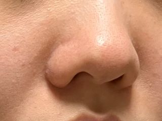 세뚜아(Cettua) 세뚜아 스티키 포어 패치 Cettua Sticky Pore Patch — 4점을 준 리뷰어가 2023년 9월 올린 사용 사진