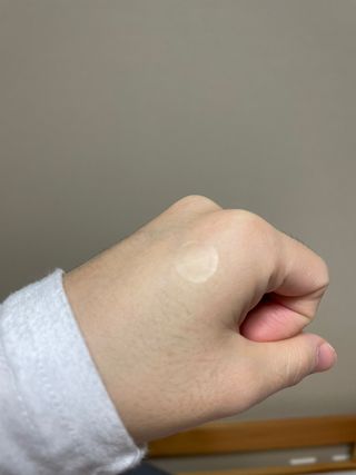 올리브영 엘라밴드 하이드로 도트 스팟패치 12mm, 티트리 — 5점을 준 리뷰어가 2022년 10월 올린 사용 사진