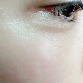 세뚜아(Cettua) 세뚜아 스팟 클리어 듀얼 패치 Cettua Spot Clear Dual Patch — 5점을 준 리뷰어가 2023년 7월 올린 사용 사진