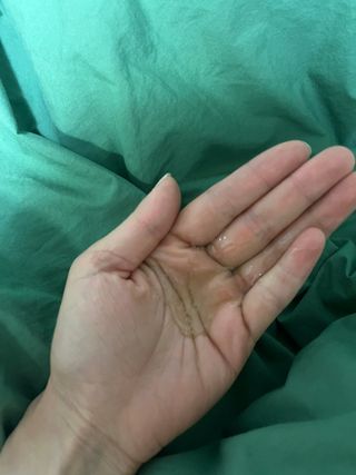 닥터시드 티트리 앤 라임 비건 지성케어 쿨 탈모 샴푸 (1000ml) — 5점을 준 리뷰어가 2023년 7월 올린 사용 사진