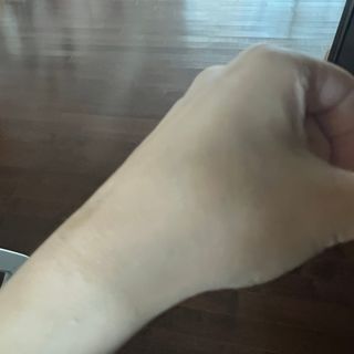 젠바이오 코스메틱스 젠바이오수딩크림]   가려운 피부 & 아토피 원픽 크림 — 5점을 준 리뷰어가 2022년 10월 올린 사용 사진