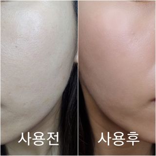 셀바이져 지우개 미스트 피부 보호 입주변 트러블 진정 케어 아기 안개분사 미스트 — 5점을 준 리뷰어가 2021년 3월 올린 사용 사진