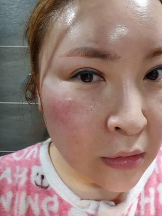 팜스테이 티트리 바이옴 카밍 아이크림 — 5점을 준 리뷰어가 2022년 2월 올린 사용 사진