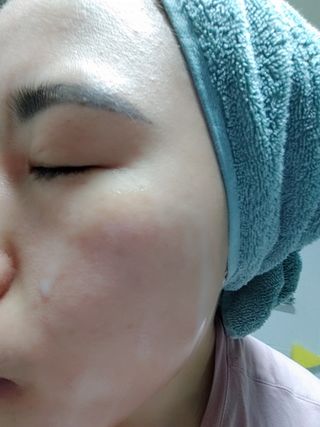 리더스코스메틱 리더스 카밍 바이오틱스 에센스 워터 — 5점을 준 리뷰어가 2022년 1월 올린 사용 사진