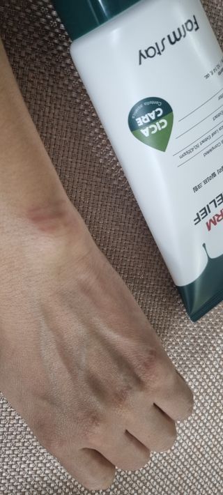 팜스테이  시카팜 데일리 릴리프 크림 — 5점을 준 리뷰어가 2022년 11월 올린 사용 사진