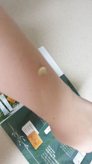 건선/아토/습진/민감성 피부 천연보습진정크림 소리온 크림 & 센시티브 크림 50g — 5점을 준 리뷰어가 2022년 3월 올린 사용 사진