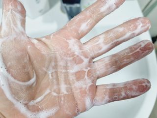 [포레스트스토리] 탈모증상완화 샴푸 1,000ml — 5점을 준 리뷰어가 2022년 3월 올린 사용 사진