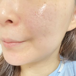 메디힐 워터마이드 포어 타이트닝 에센스 패드 — 5점을 준 리뷰어가 2021년 9월 올린 사용 사진