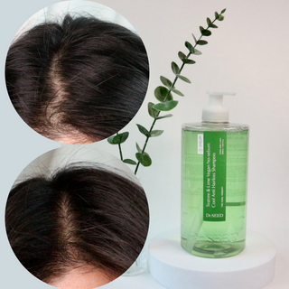 닥터시드 티트리 앤 라임 비건 지성케어 쿨 탈모 샴푸 (1000ml) — 5점을 준 리뷰어가 2024년 4월 올린 사용 사진