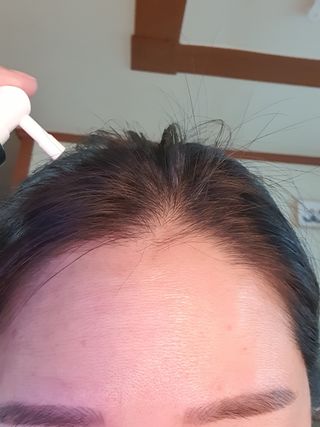 모두발라 탈모집중케어 헤어토닉 — 5점을 준 리뷰어가 2021년 12월 올린 사용 사진