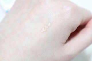 히루스카 포스트아크네 클리어 — 2점을 준 리뷰어가 2021년 2월 올린 사용 사진