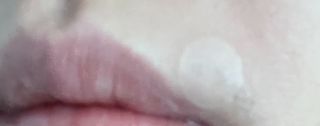3M 넥스케어 블레미쉬 여드름패치 릴리프 111매(짜기 전 케어) +알코올스왑 증정 — 5점을 준 리뷰어가 2024년 5월 올린 사용 사진