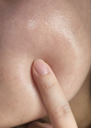 난나 살몬 스파이더 검버섯 미백 톤업 화이트닝 연어 앰플 크림 300ml 대용량 — 5점을 준 리뷰어가 2022년 8월 올린 사용 사진