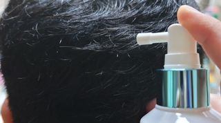 모두발라 탈모집중케어 헤어토닉 — 5점을 준 리뷰어가 2021년 12월 올린 사용 사진