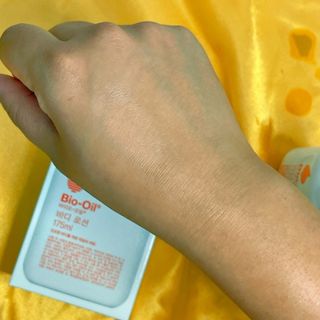 바이오오일 [바이오-오일] 바디 로션 175ml — 5점을 준 리뷰어가 2021년 11월 올린 사용 사진