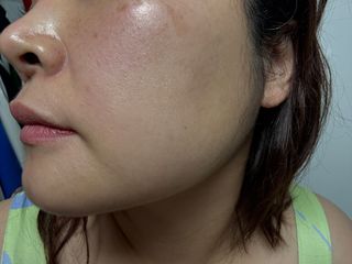 하이브리온 [쿠팡 구매평] 닥터초이스 멜라제로 스템셀 엑소좀 화이트닝 앰플 40g , 1개 — 5점을 준 리뷰어가 2025년 5월 올린 사용 사진
