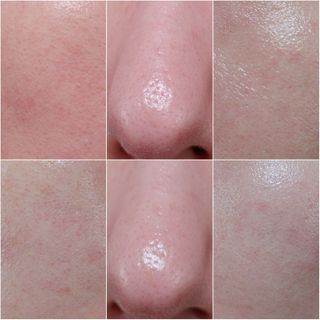 냉장고에 넣어요, 붉은 트러블 피부 다음날 진정되요 [버진팜스 푸딩수딩아토] — 4.5점을 준 리뷰어가 2021년 1월 올린 사용 사진