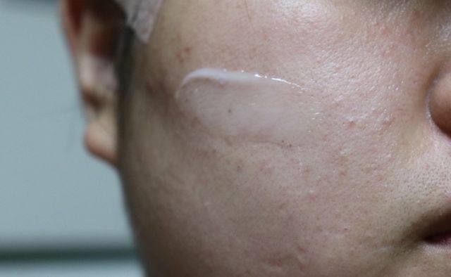 메디힐 바오밥 수딩 수분 크림 리뷰 사진